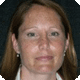 Laura Allen Phillips